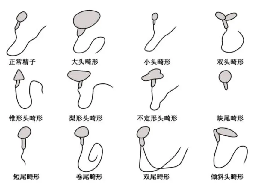 精子正常形态特征 精子存活时间与游动方式