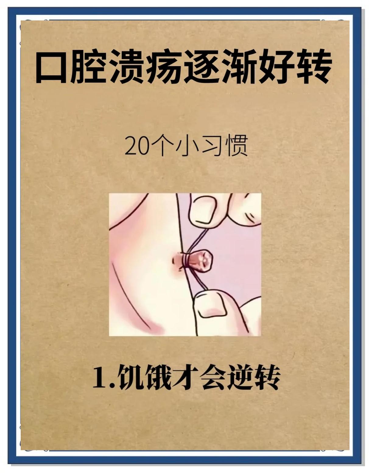 如何预防口腔溃疡 口腔溃疡最有效预防方法