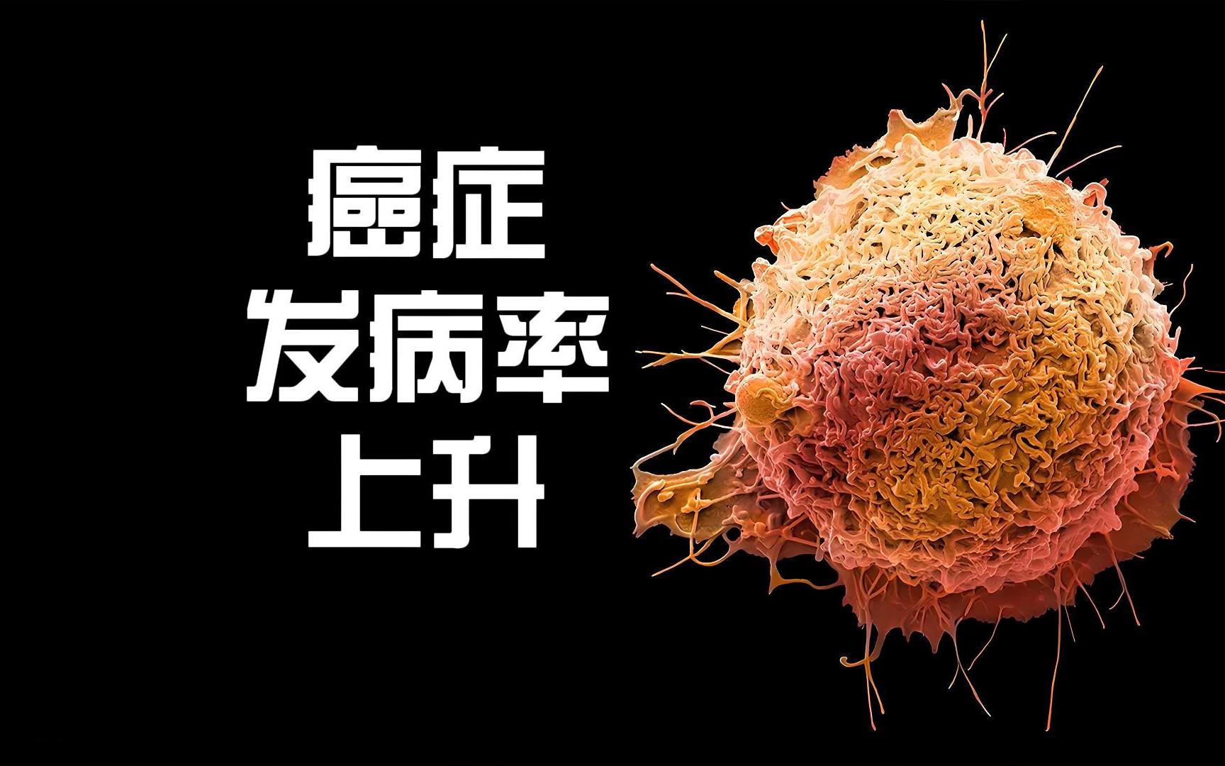 癌症发病率持续攀升 主要诱因有哪些