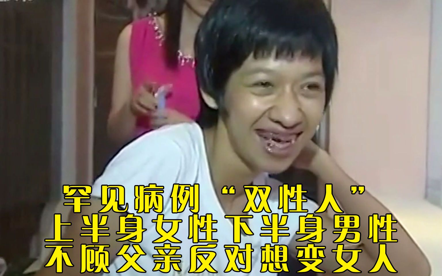 雌雄同体人真的能生育吗？揭开双性人的神秘面纱！