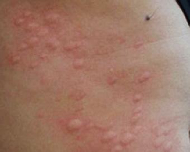 近期出现的病毒叫什么