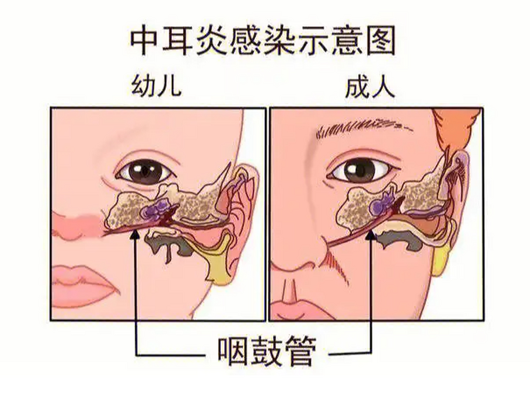 猪蓝耳病有什么症状 蓝耳病和非洲猪瘟的区别及防治