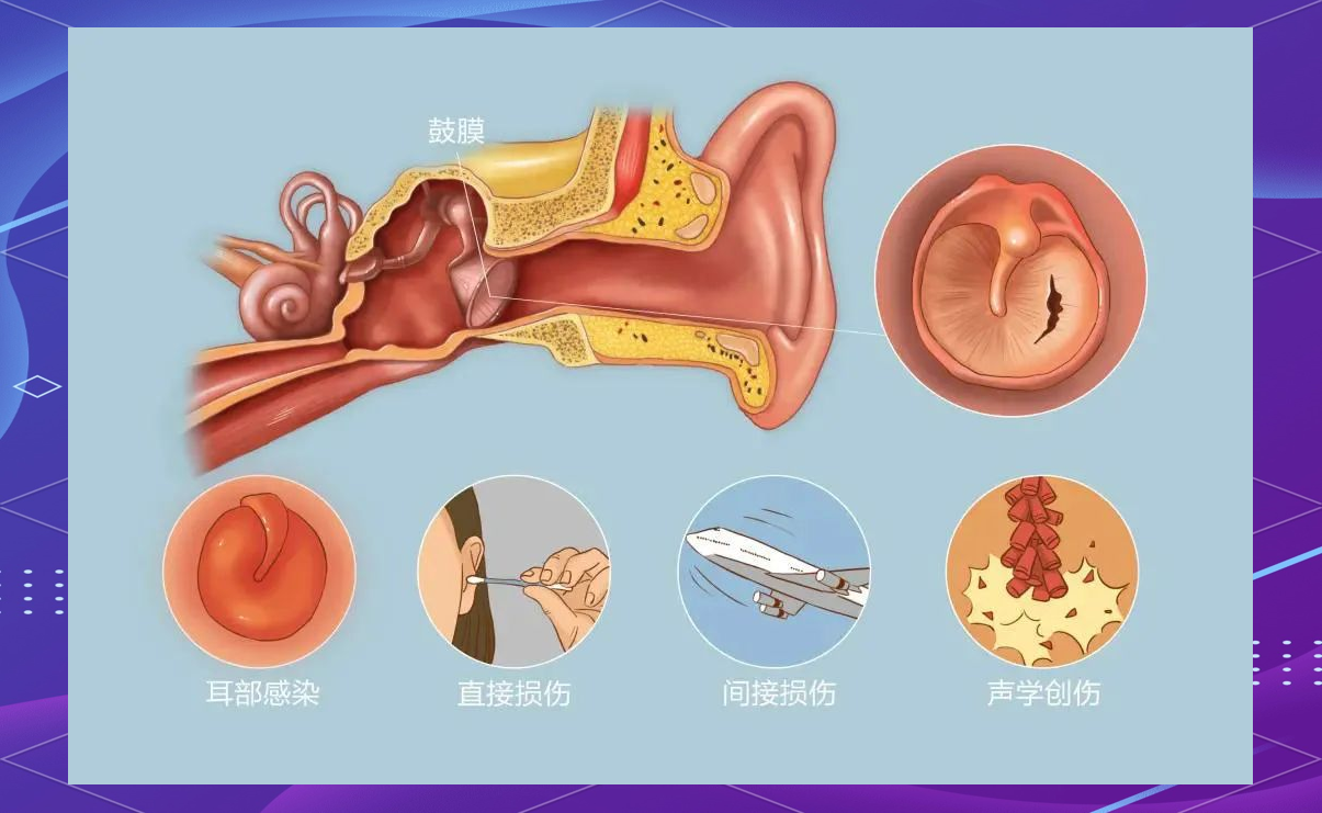 掏耳朵上瘾与玩游戏上瘾的有什么异同？...