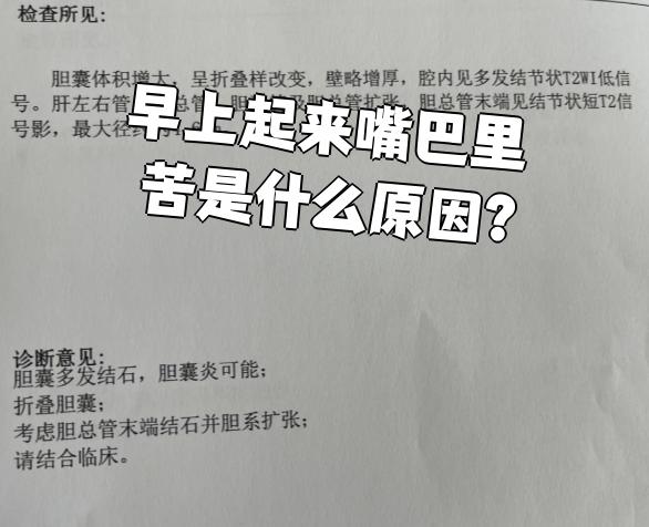 口苦是怎么回事?
