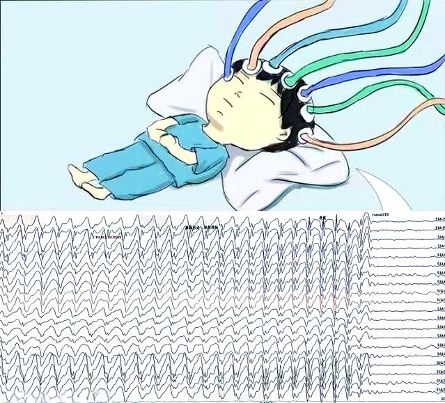 走神时大脑更活跃 大脑老是走神原因 做事总走神怎么办