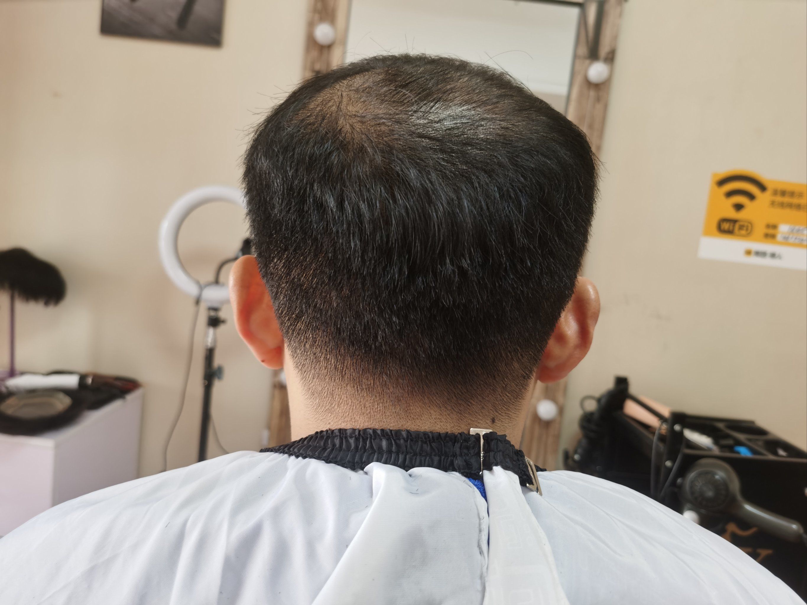 “我变秃了,也变强了”有科学根据吗?如何面对秃如其...