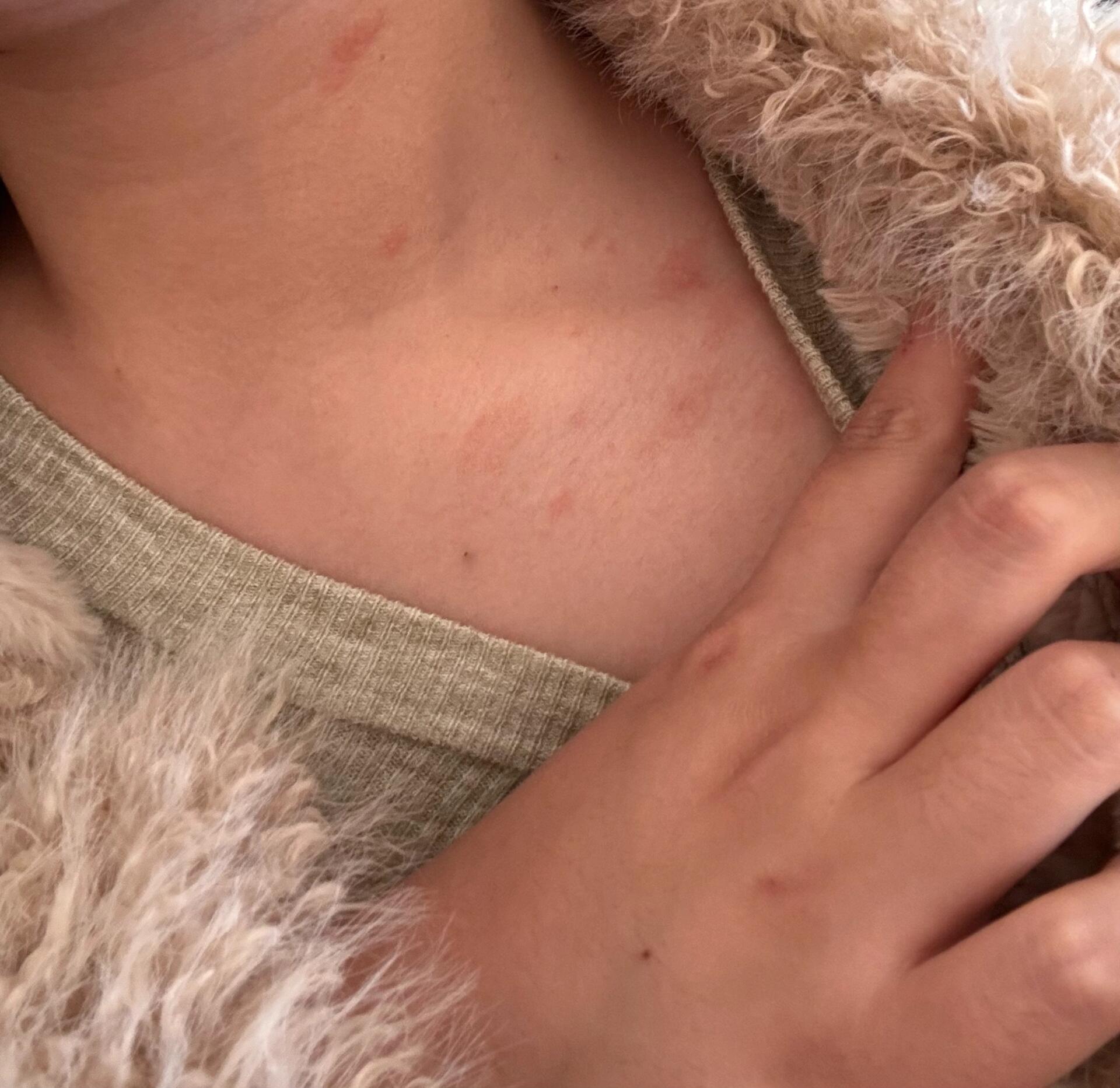 不痛不痒,竟然得了糖尿病?...