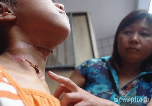 什么是虐童？虐童又为何在家庭中发生？...