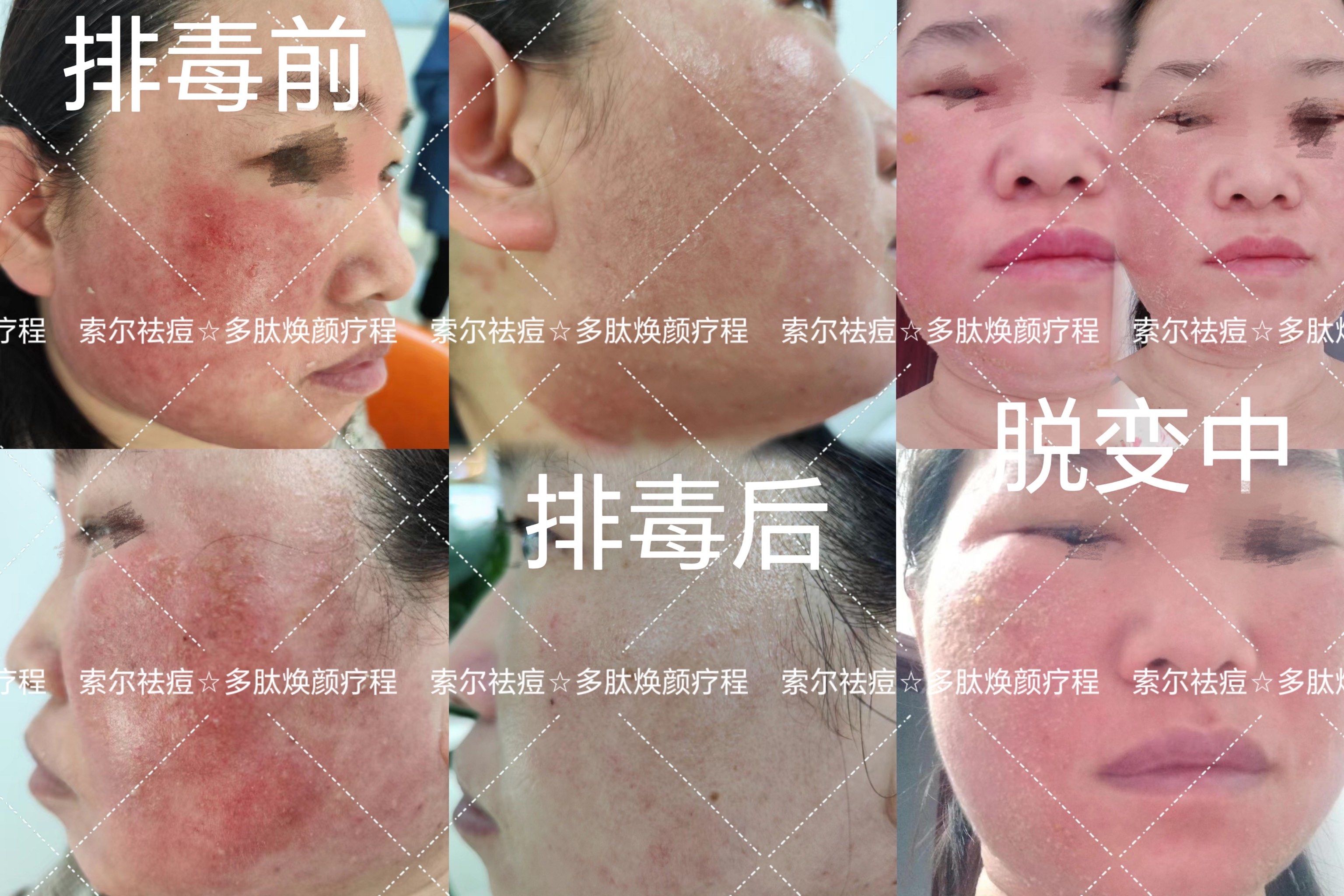 为什么说激素是把双刃剑？...